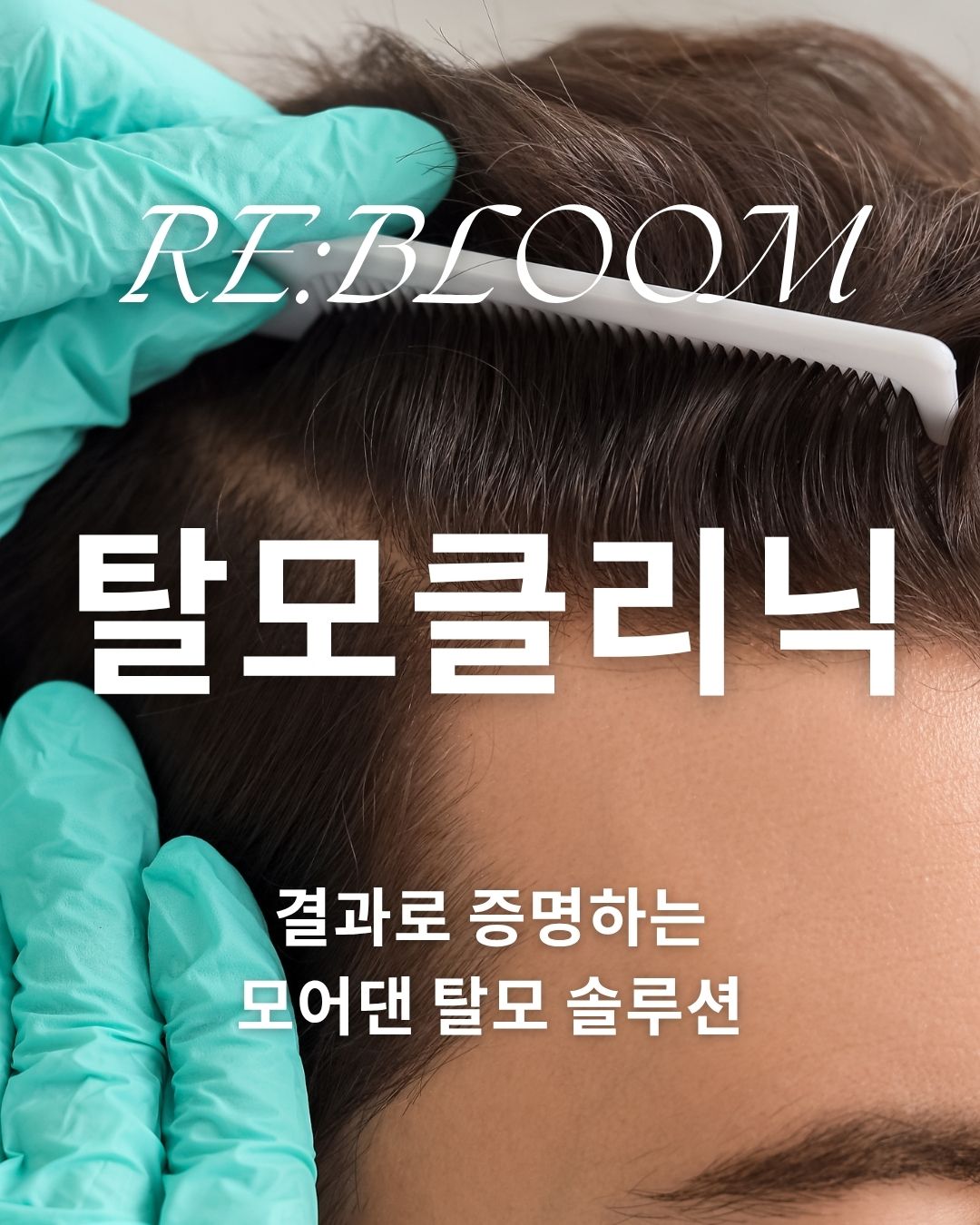 의정부 탈모병원