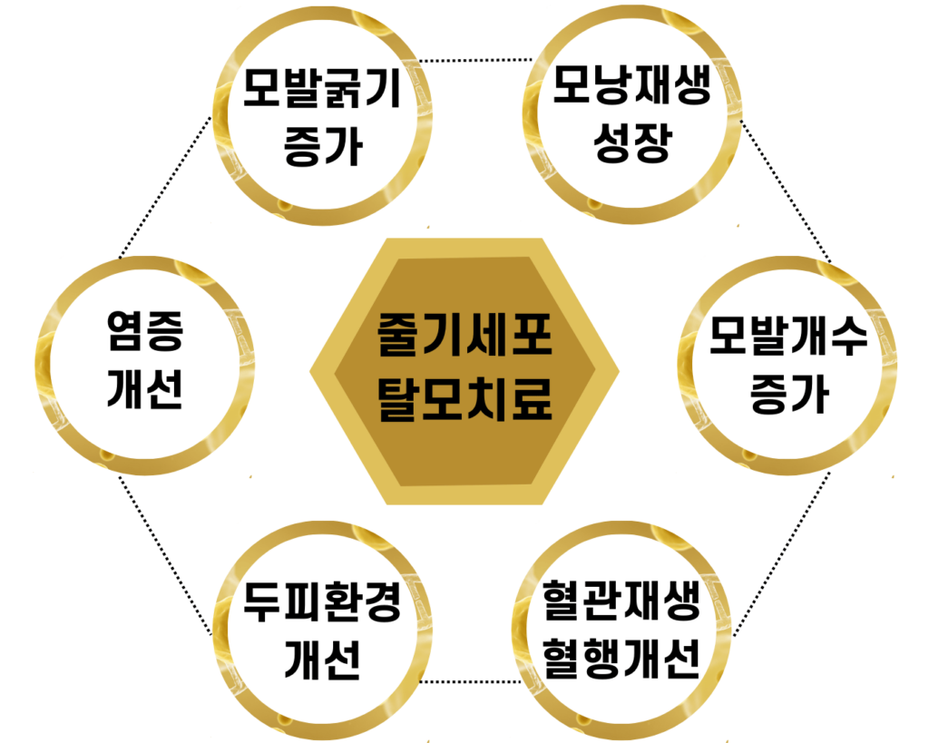 의정부 탈모치료 의정부 탈모치료