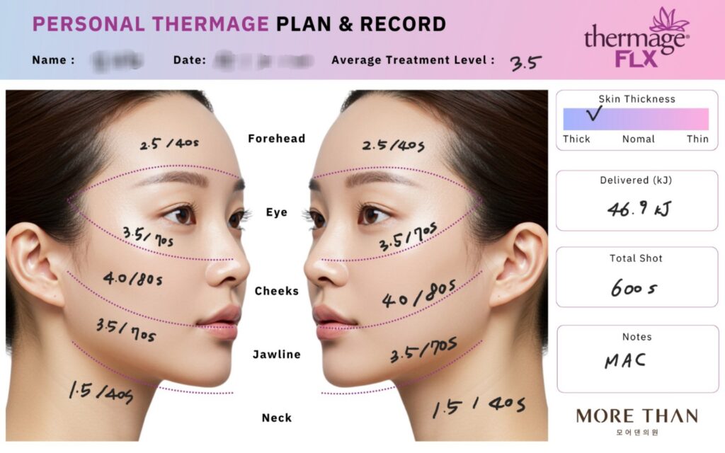 의정부써마지