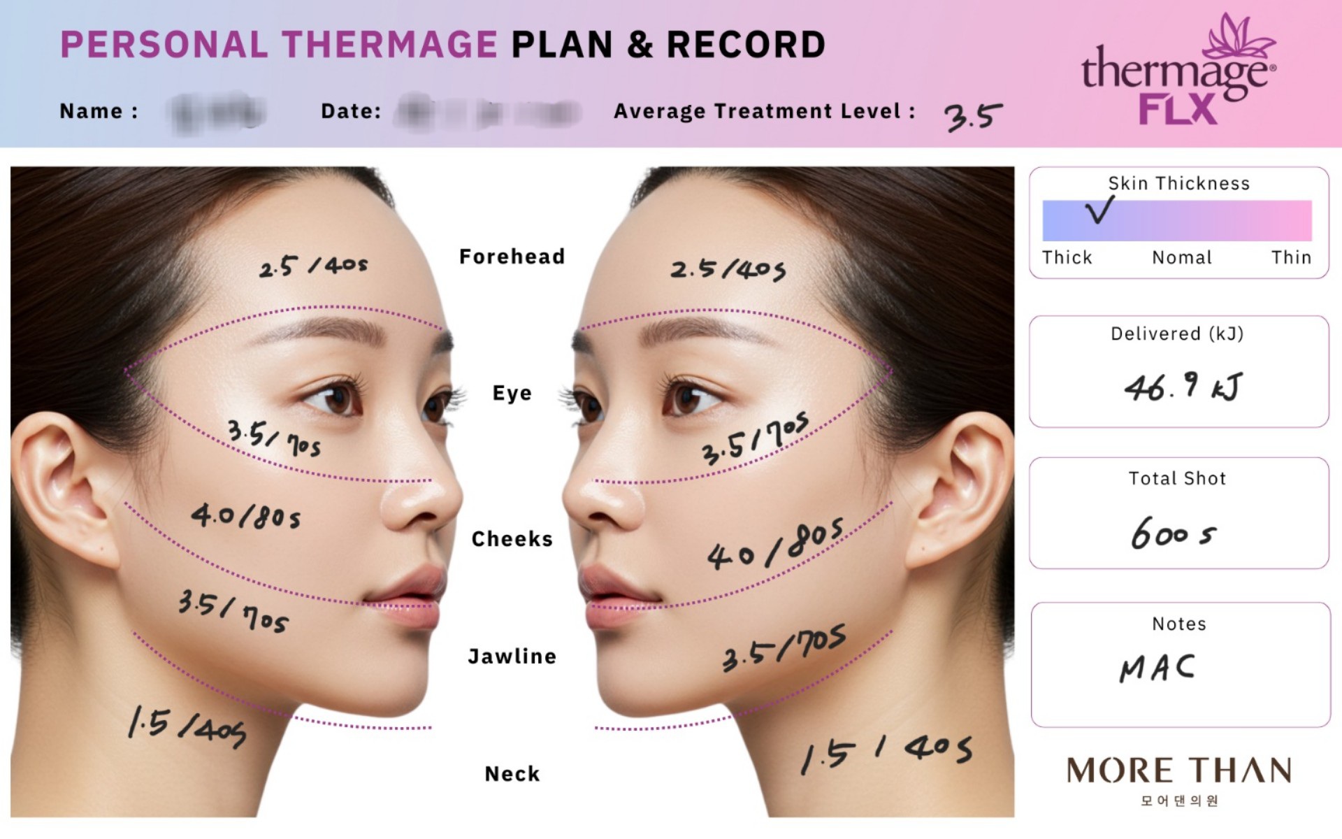 의정부써마지 의정부써마지