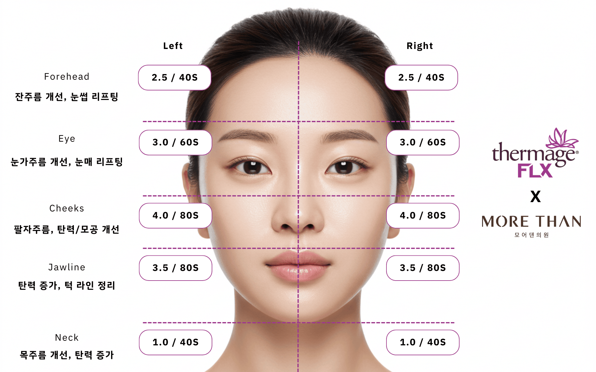 의정부써마지 의정부써마지