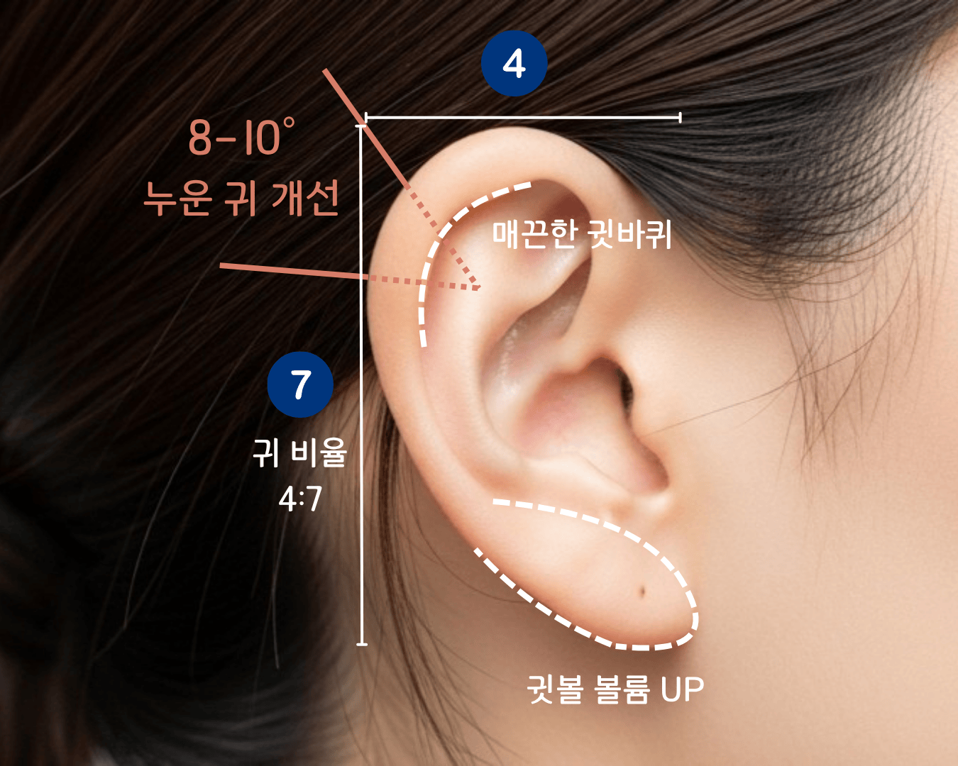 의정부 귀필러