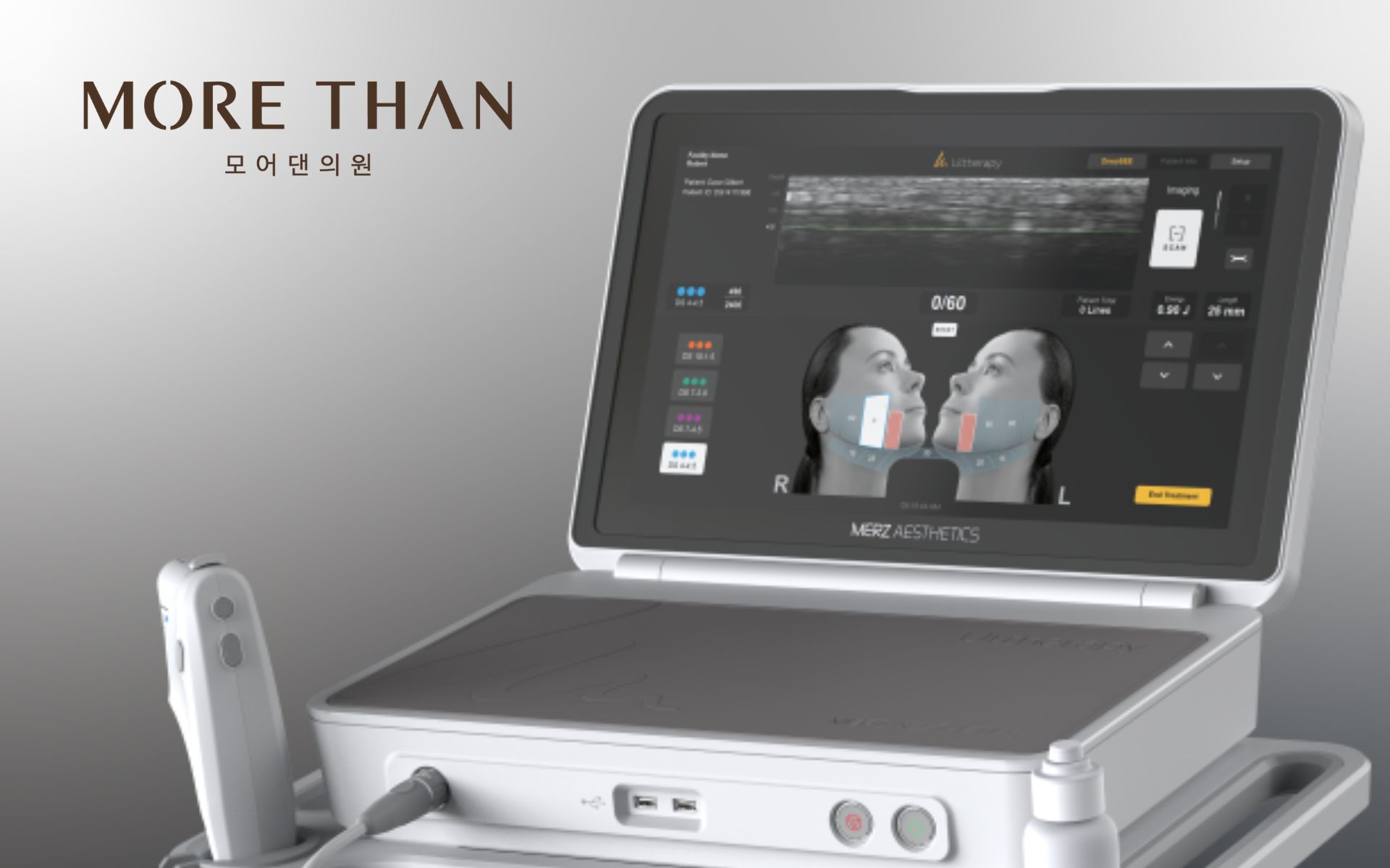 의정부울쎄라 의정부울쎄라