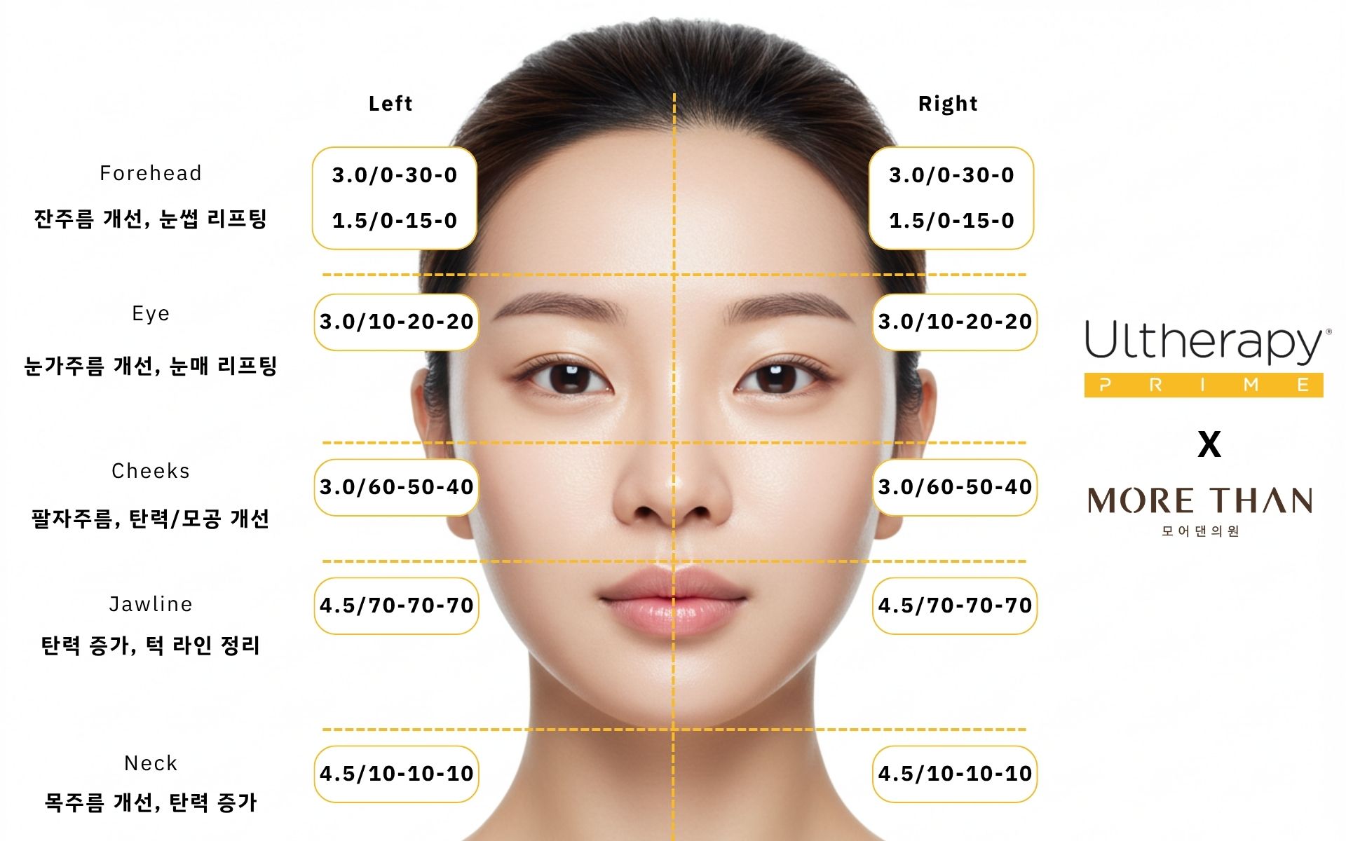 의정부울쎄라 의정부울쎄라