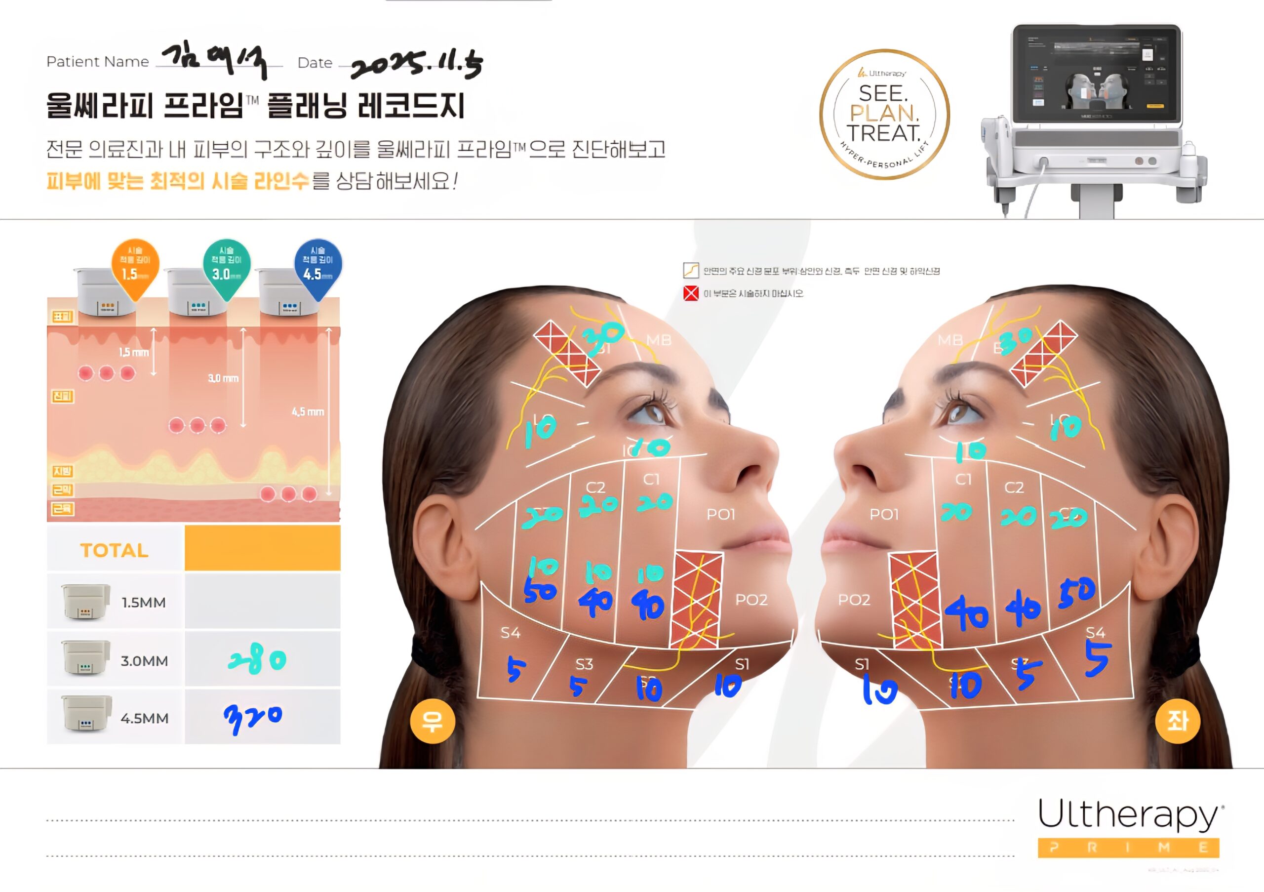 의정부울쎄라 의정부울쎄라