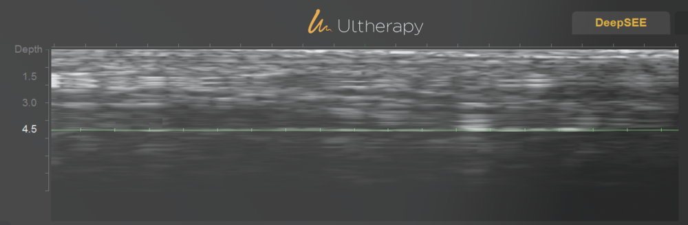 의정부울쎄라 의정부울쎄라