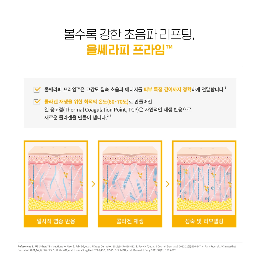 의정부울쎄라 의정부울쎄라