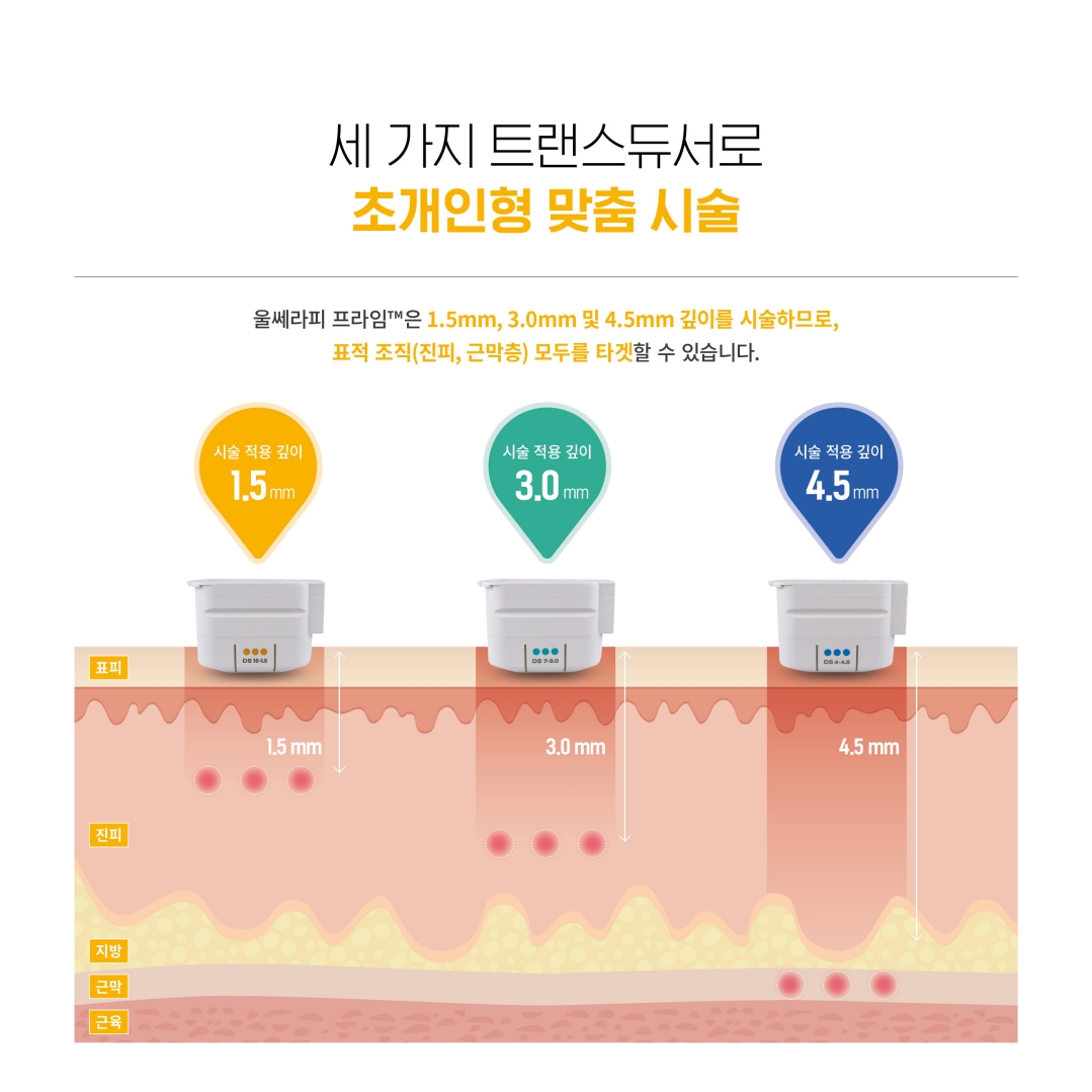 의정부울쎄라 의정부울쎄라