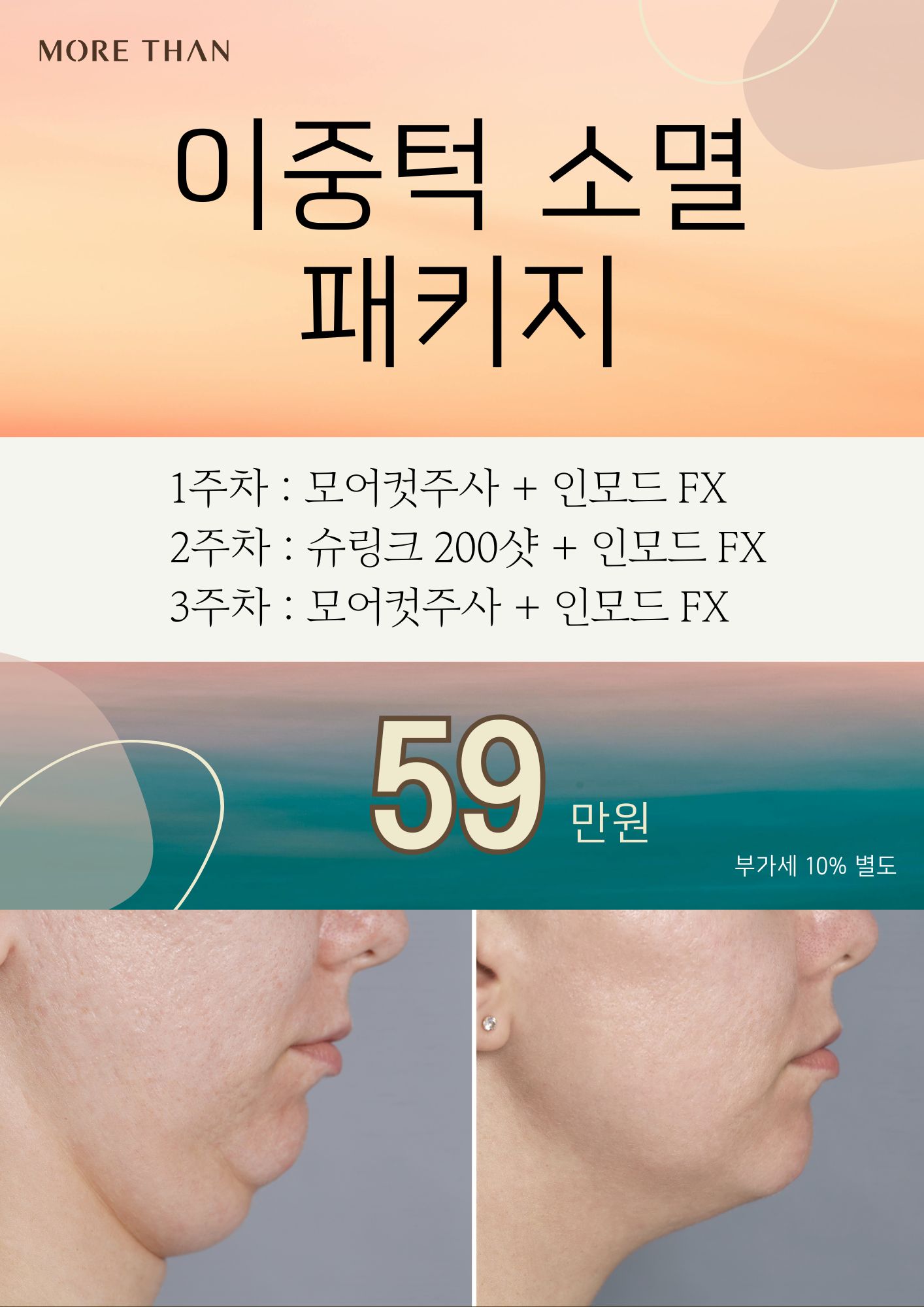 의정부피부과